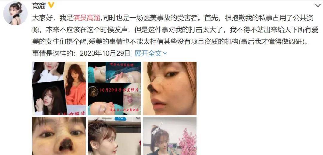 整容毁掉事业的女明星_张檬整容前后对比_娱乐圈没整过容的明星